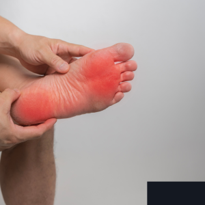 Plantar fasciitis heel pain illustration showing foot inflammation need treatment from a chiropractor near Stratford